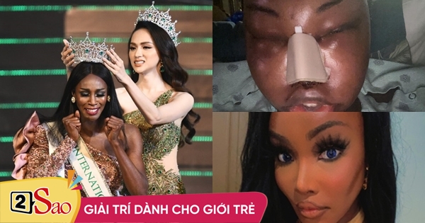 Người kế nhiệm Hương Giang đập mặt xây lại thất bại?