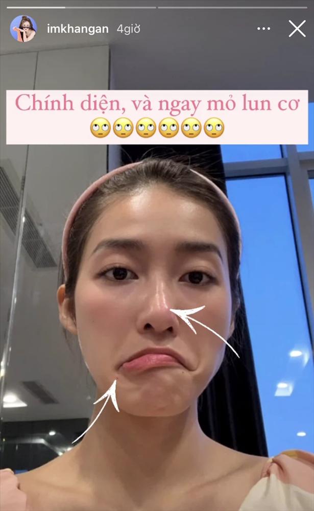 Sao Việt chăm chỉ skincare nhưng trớ trêu thay mặt vẫn đầy mụn-6