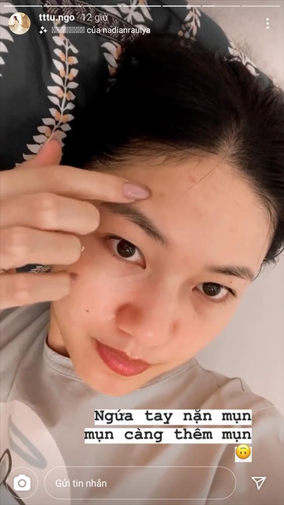 Sao Việt chăm chỉ skincare nhưng trớ trêu thay mặt vẫn đầy mụn-3