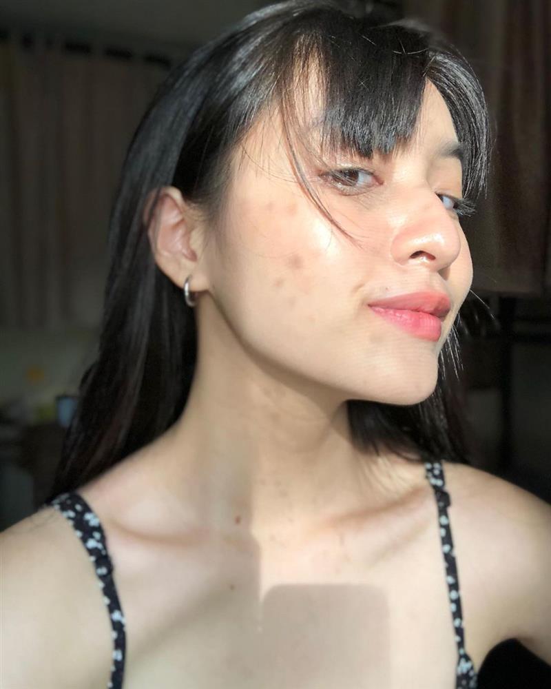 Sao Việt chăm chỉ skincare nhưng trớ trêu thay mặt vẫn đầy mụn-7