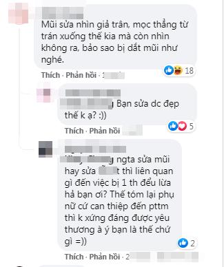 Thiên An bị fan Jack tố ngược: Mũi mọc từ trán, dao kéo giả trân?-4