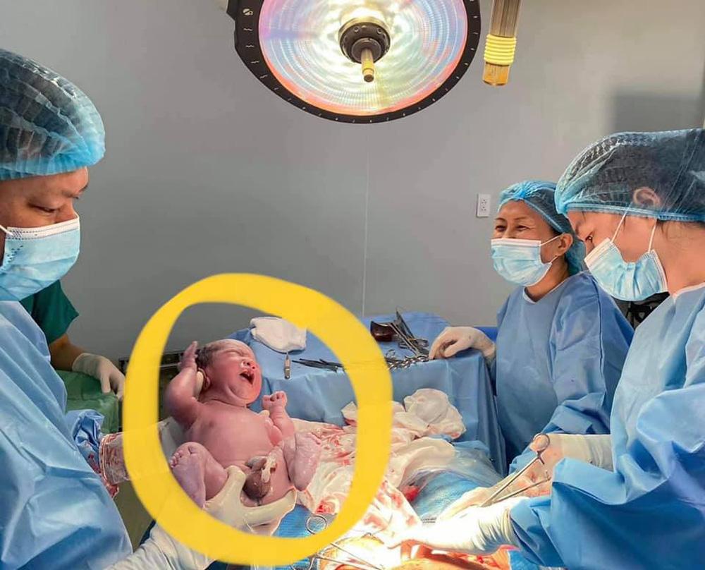 Vụ bác sĩ rút máy thở của mẹ nhường sản phụ có 5 điểm bất thường-3