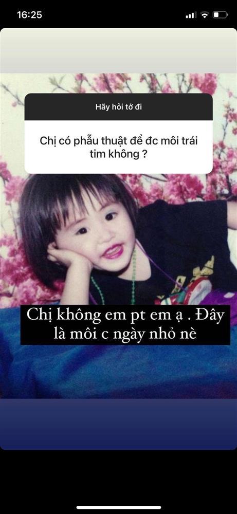 Du Uyên thừa nhận sửa 1 bộ phận trên mặt còn hối hận khi yêu Đạt G-1