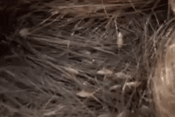 Rùng mình nghìn con chấy tranh nhau làm tổ trên đầu bé gái-1