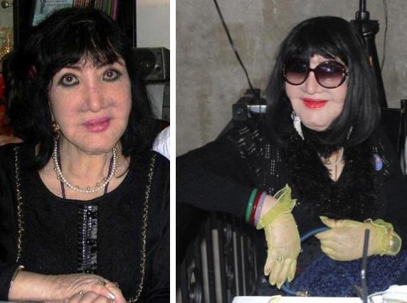 Thảm họa dao kéo đầu tiên ở Việt Nam: Hậu thế không khỏi xót xa-9