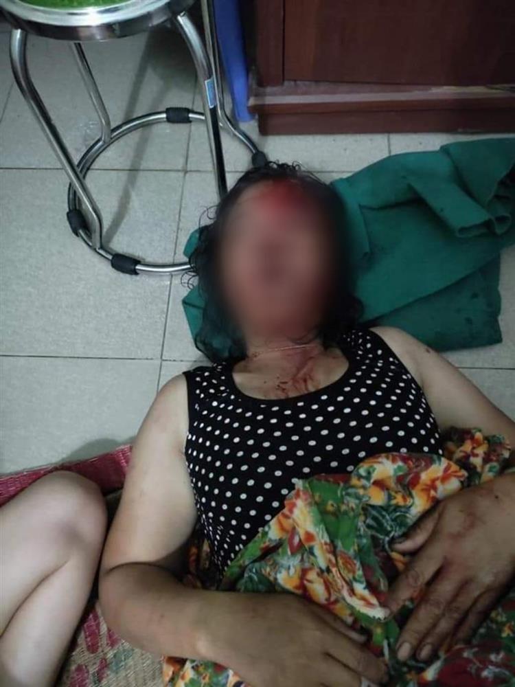 Hải Dương: Vợ tố cáo chồng tra tấn dã man, chích điện, dìm xuống ao-2