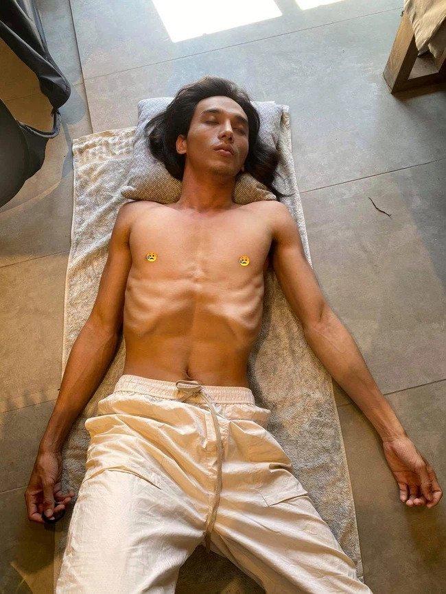 Ngoại hình gây sốc của sao nam lộ ảnh da bọc xương ở tuổi 29-2