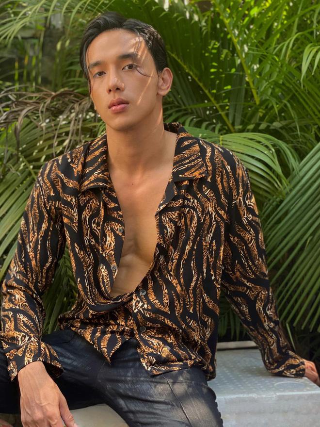 Ngoại hình gây sốc của sao nam lộ ảnh da bọc xương ở tuổi 29-4