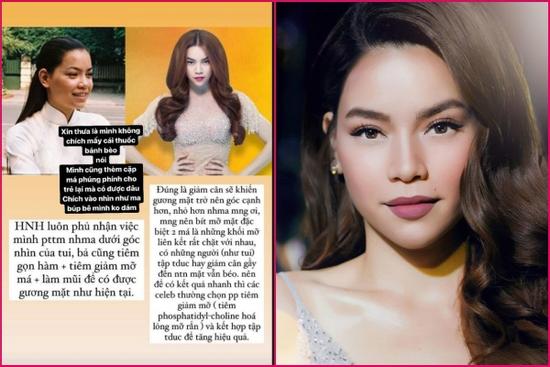 Hồ Ngọc Hà 'dằn mặt' người nói mình tiêm gọn hàm, tan mỡ mặt