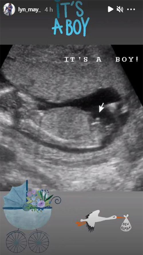 Diễn viên 68 tuổi tiết lộ mang thai, bồ trẻ sốc-2