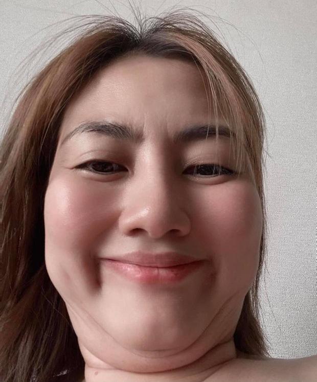 Ngọc Lan tăng cân lộ nọng cằm siêu to khổng lồ-1