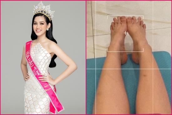 Bàn chân Hoa hậu Đỗ Thị Hà sao lại kỳ dị đến thế này?