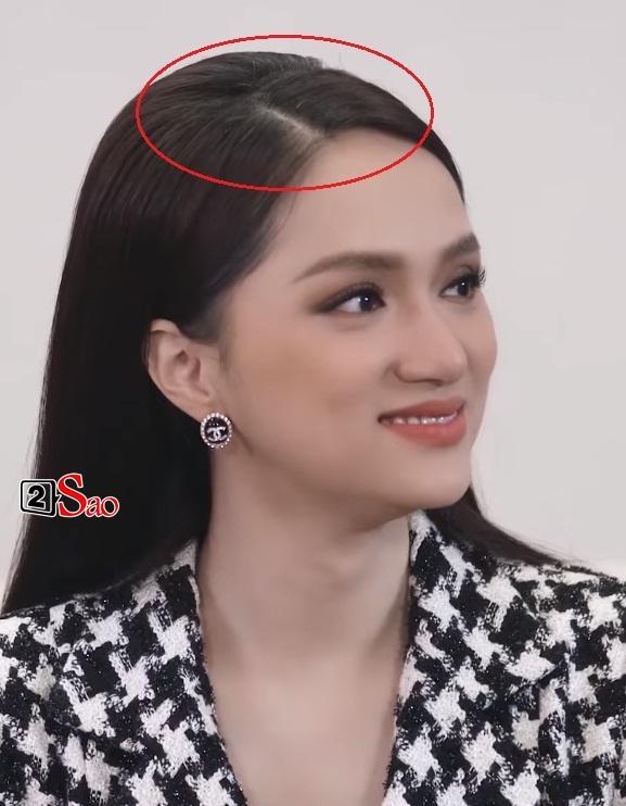 Bí kíp giải quyết tóc bạc sớm ở tuổi 30 như Hà Hồ, Mai Phương Thúy-4