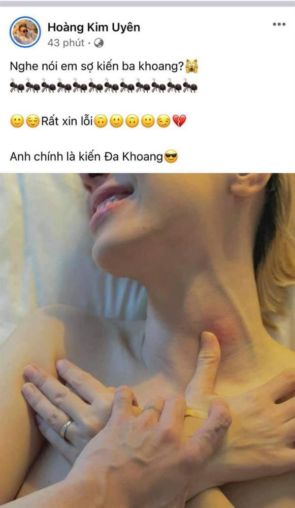 Miko Lan Trinh và tình chuyển giới chính thức hé lộ kế hoạch kết hôn-6