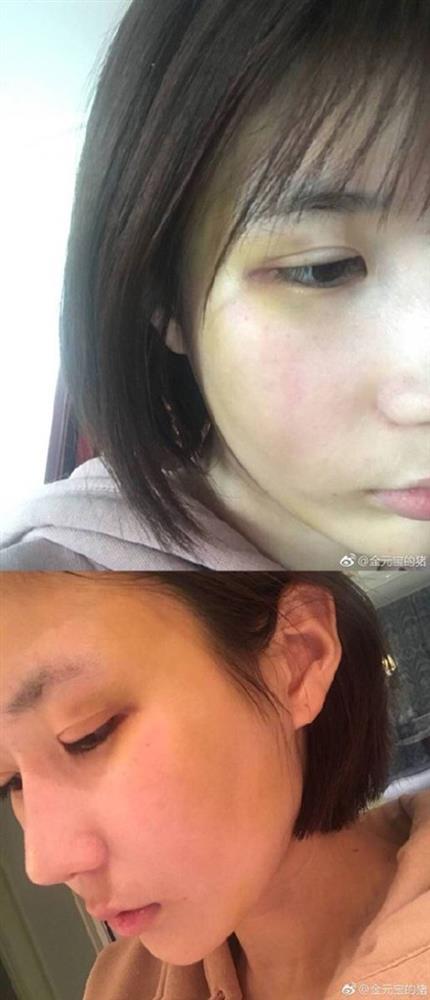 Tình cũ Hứa Khải lật scandal bạo hành, biến căng sắp ập Cbiz-2