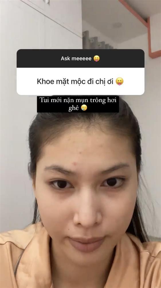 Á hậu Ngọc Thảo lộ môi thâm xì, da đầy mụn sau lớp make up vi diệu-3