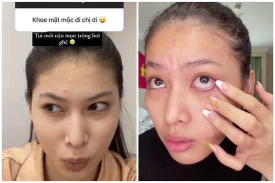 Á hậu Ngọc Thảo lộ môi thâm xì, da đầy mụn sau lớp make up vi diệu