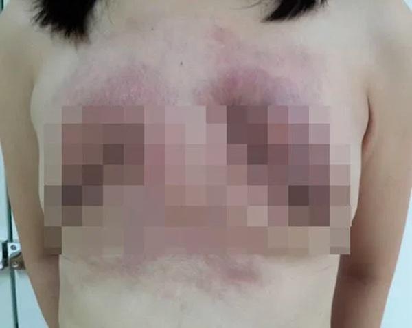 Ngực chẳng những không tròn đầy mà trở nên bẹt dí.