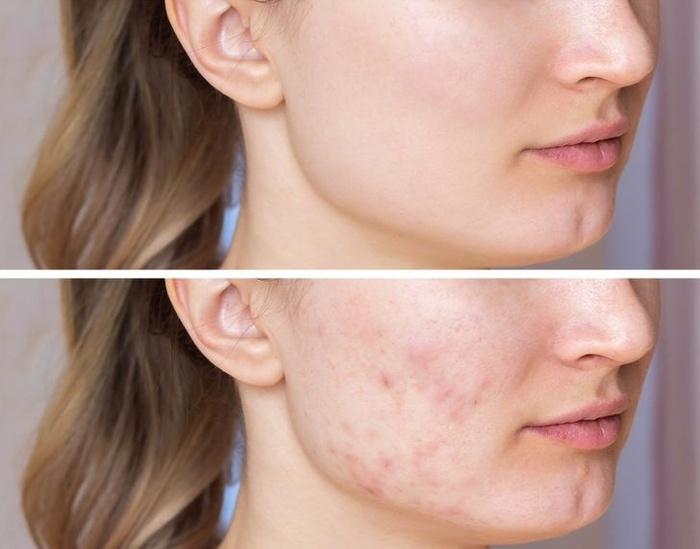 Lạ mà thật: Rửa mặt dưới vòi hoa sen dễ hình thành nếp nhăn xấu xí-4