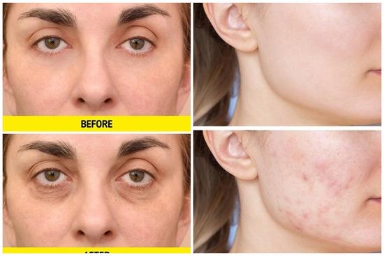 Lạ mà thật: Rửa mặt dưới vòi hoa sen dễ hình thành nếp nhăn xấu xí