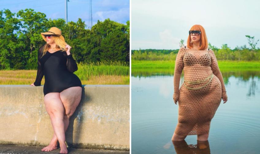 Người mẫu mắc chứng phù mỡ, từng nặng 192 kg-1