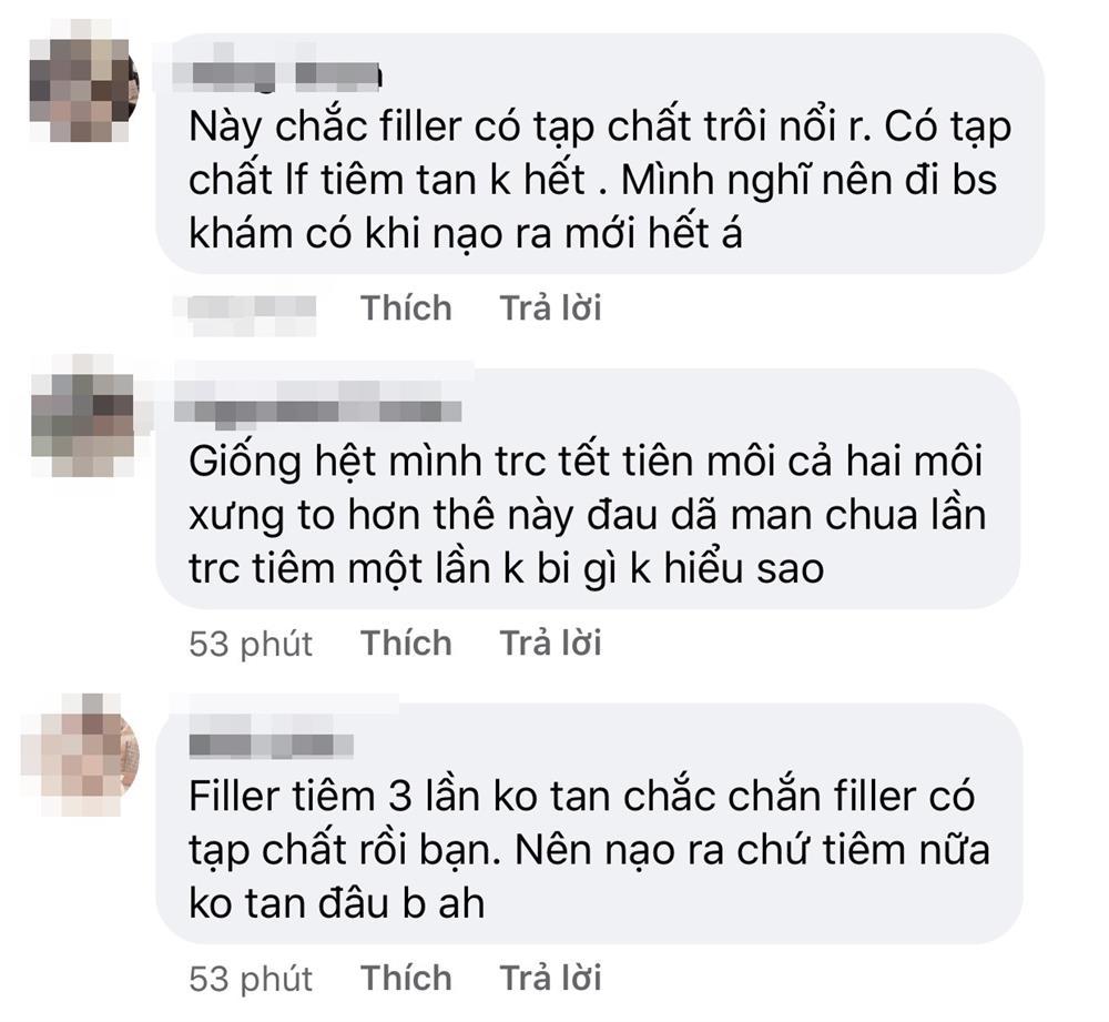 Ham hố tiêm filler, gái xinh khóc thét vì môi cuốn lô hệt gái ngành-5