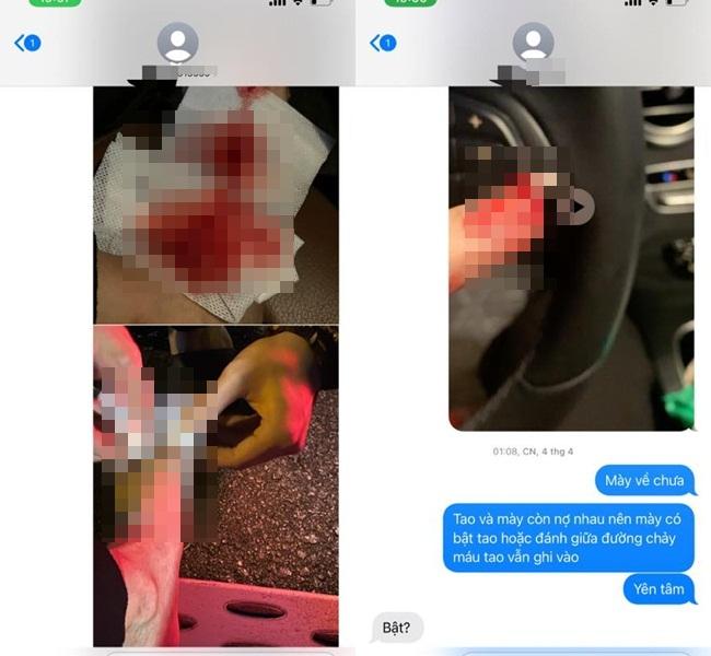 Quế Vân tố bạn trai chuyên lừa tình, đổ tội 4 phụ nữ trói bầu-8