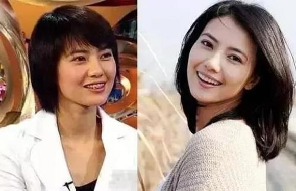 Lâm Tâm Như và loạt sao Cbiz lột xác sau khi phẫu thuật răng-6