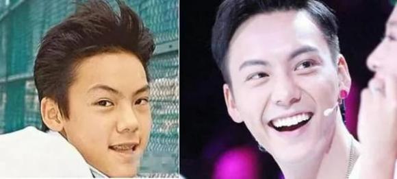 Lâm Tâm Như và loạt sao Cbiz lột xác sau khi phẫu thuật răng-7