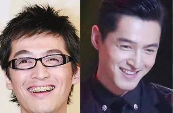 Lâm Tâm Như và loạt sao Cbiz lột xác sau khi phẫu thuật răng-8