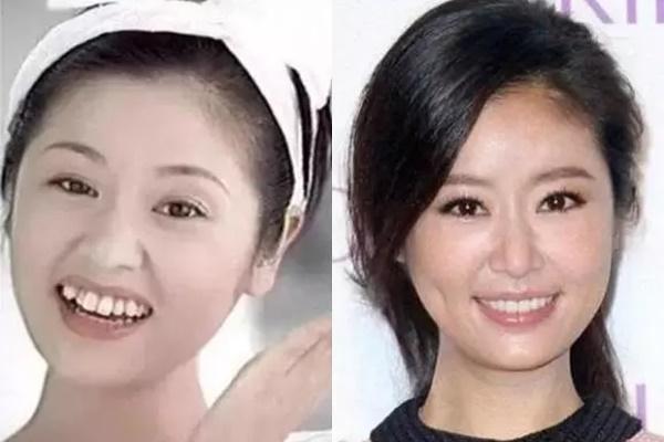 Lâm Tâm Như lộ hết khuyết điểm bên Dương Mịch 11 năm trước-4