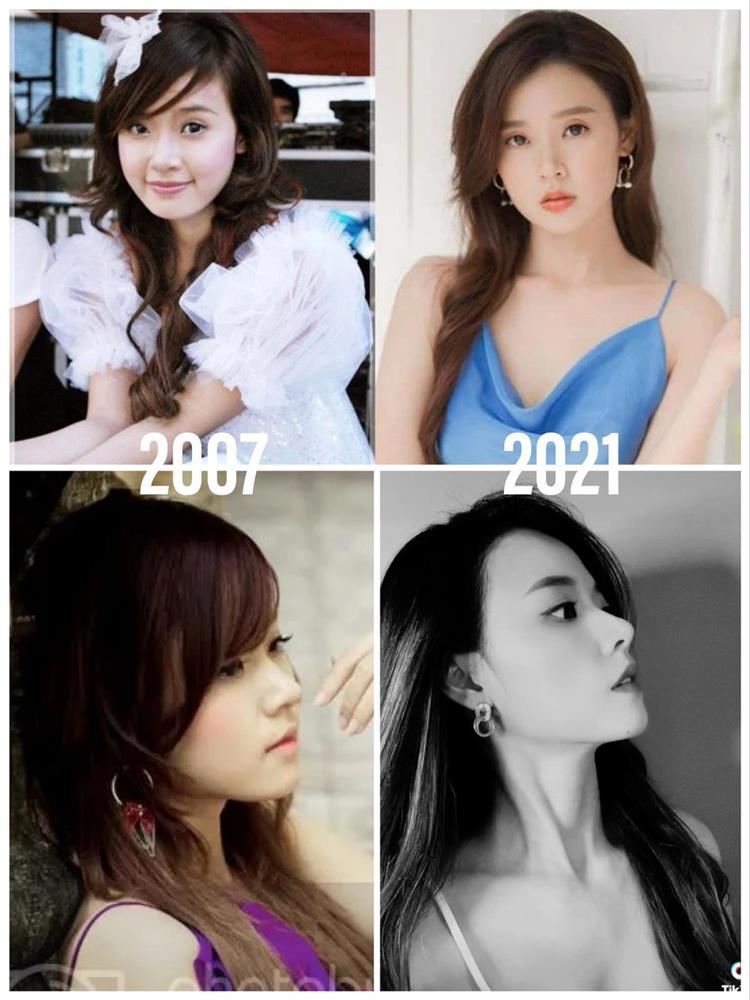 Midu véo mũi, nắn cằm khẳng định hàng real không dao kéo-2