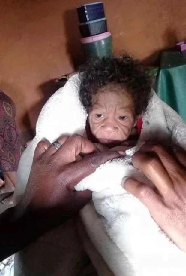 Vừa sinh con gái nhỏ, mẹ rụng rời tay chân khi nhìn thấy mặt em-1