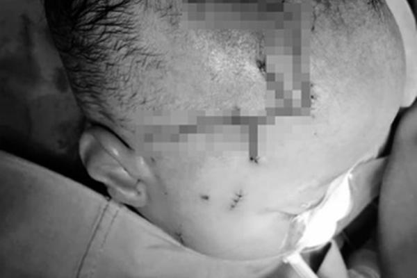 Cụ bà bị chó dữ cắn tử vong, tài xế bỏ đi như không thấy gì-2