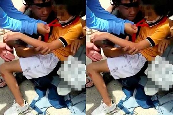 Cứu cô gái kẹt cánh tay vào bánh xe vì vướng áo chống nắng-1