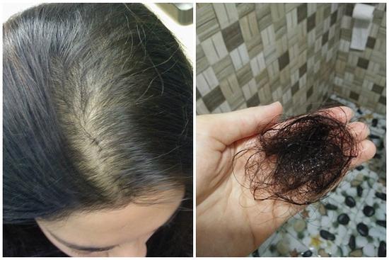 Thu đi để lại lá vàng, chải qua chải lại tóc càng xác xơ