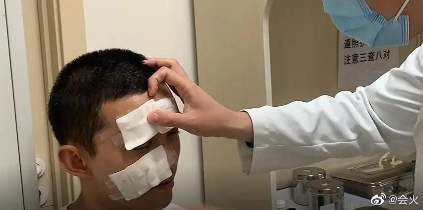 Ngô Lỗi bị thương khắp mặt vì vụ nổ trên phim trường-7