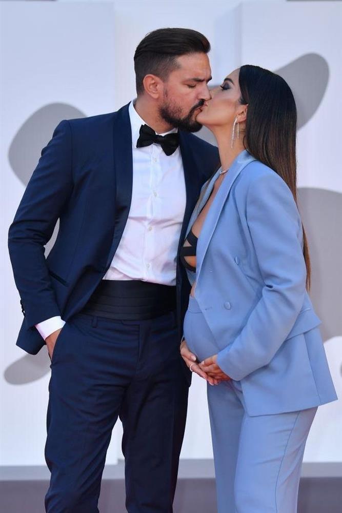 Người mẫu bị rơi váy lộ ngực trên thảm đỏ Liên hoan phim Venice-11