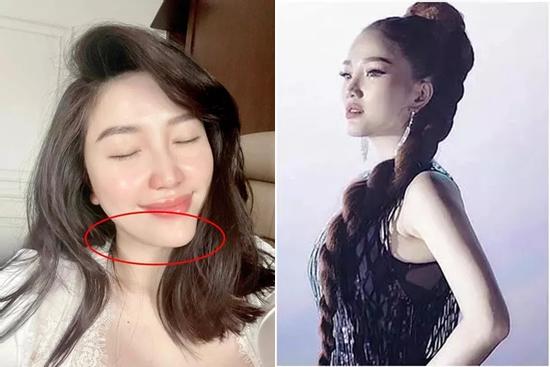 Bảo Thy xuất hiện với chiếc cằm lệch, nghi 'gọt mặt 80 lần'