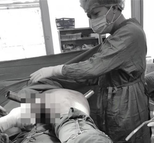 Thanh niên bị thanh sắt xuyên từ đùi ra sau, treo trên thành cầu-2