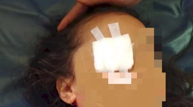 Rúng động: Bé gái bị người thân móc mắt để làm lễ cầu tài lộc-1