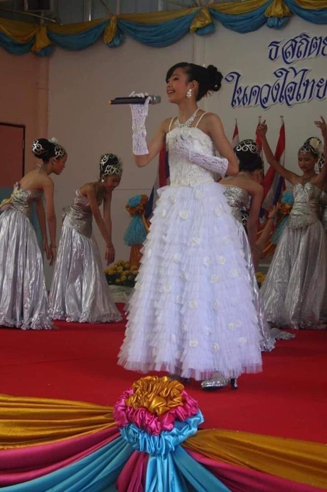 Lisa BLACKPINK bị đào mộ ảnh thời mũi tẹt dí nghi dao kéo-11