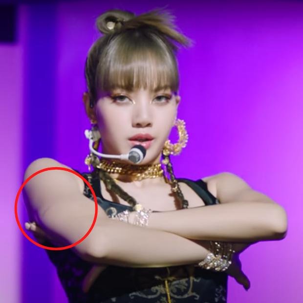 Fan xót khi Lisa BLACKPINK bị thương để lại sẹo vì đu dây mạo hiểm-2