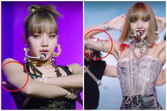 Fan xót khi Lisa BLACKPINK bị thương để lại sẹo vì đu dây mạo hiểm