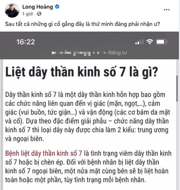 Lou Hoàng liệt dây thần kinh số 7, nửa mặt không cử động được?-1