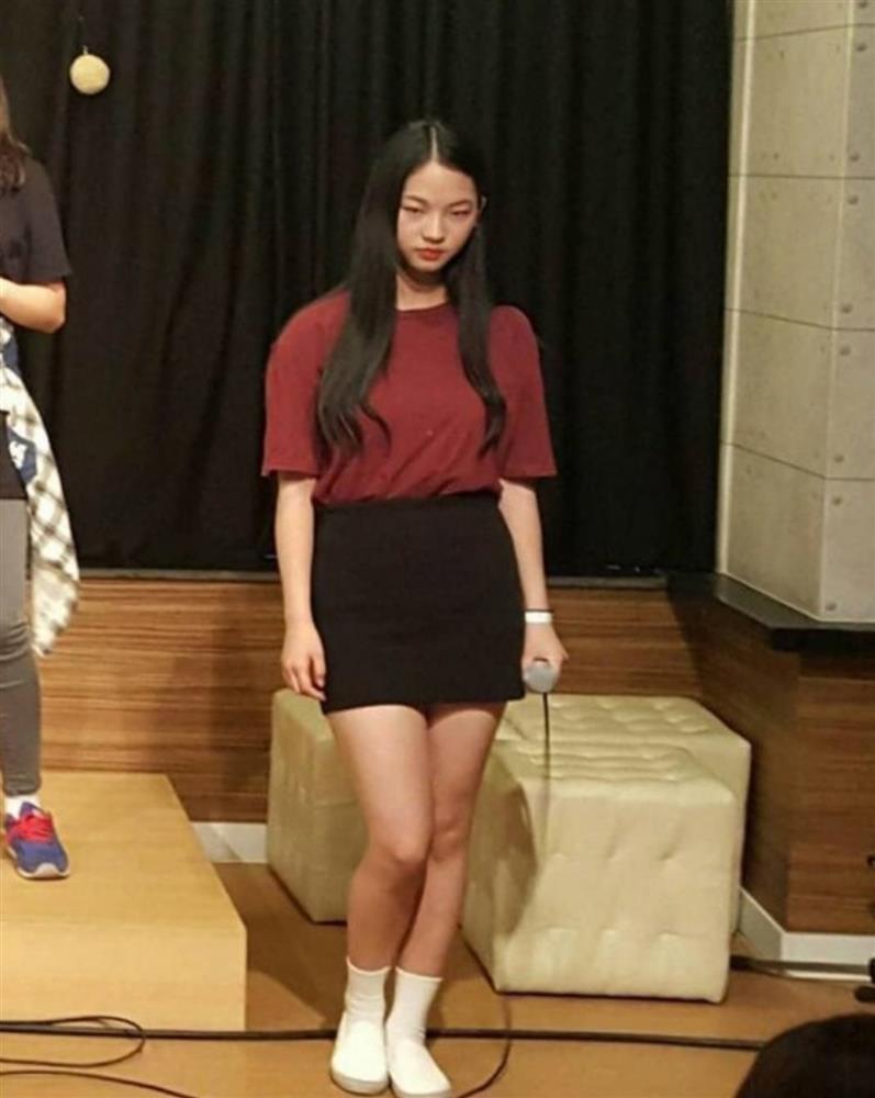 Mỹ nữ Hàn nghi thẩm mỹ, quá khứ và hiện tại khác xa-5