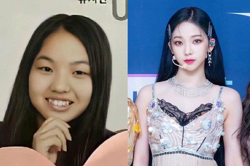 30 giờ trong BV thẩm mỹ hút mỡ bụng và cái chết ám ảnh-2