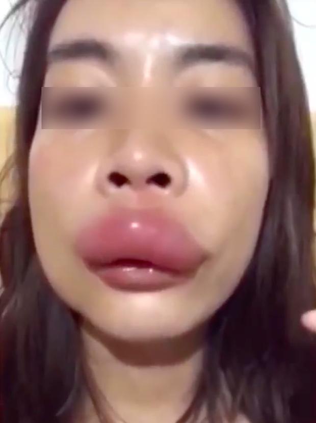 Gái xinh ra tận vườn ăn mật ong, về nhà nhìn môi sưng như đỉa-7