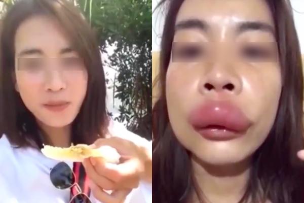 Những món đại kỵ mật ong, ăn không cẩn thận là nhập viện-8