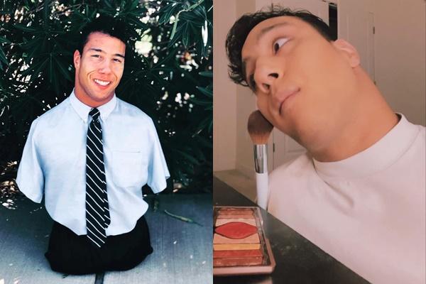 Diễn giả không chân tay và chuyện tình đồng tính gây bão-5